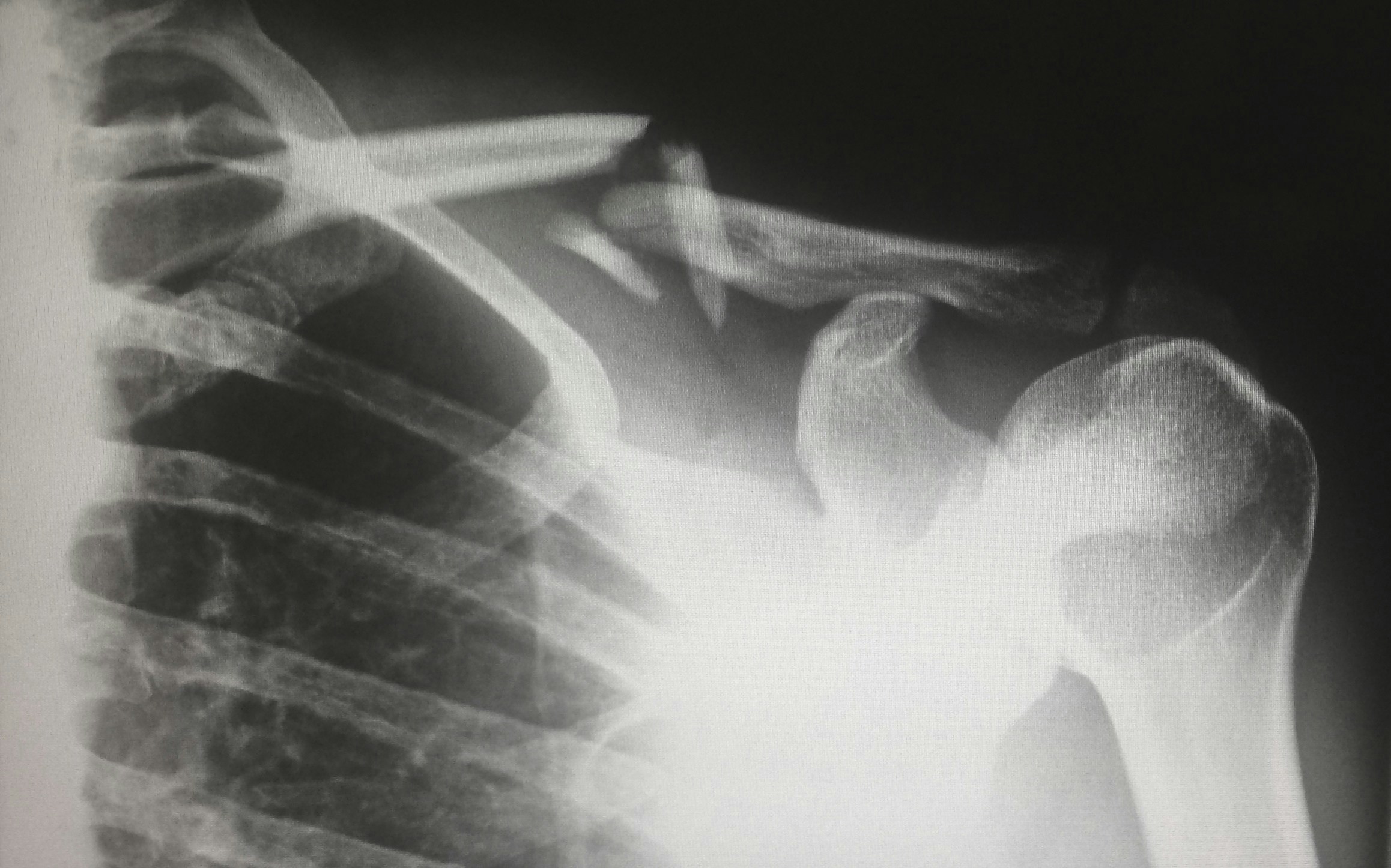 Why Does SEO For Personal Injury Lawyers Matter